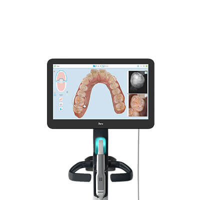 itero digital impression system